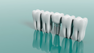 a dental implant against a green background